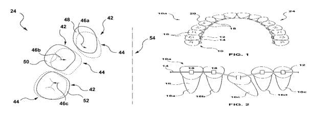 Today’s Patent – System And A Method For Adjusting An Orthodontic Treatment Plan