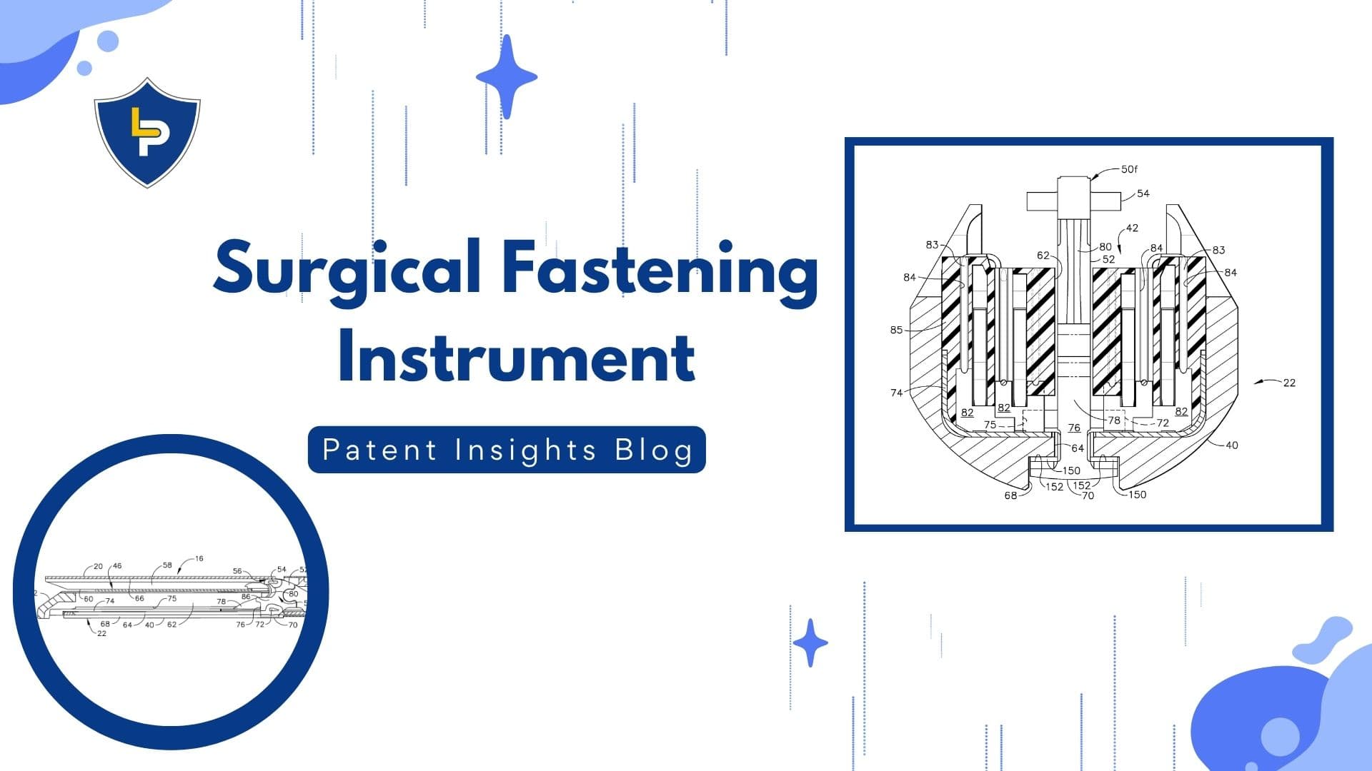 Today’s Patent: Surgical Fastening Instrument
