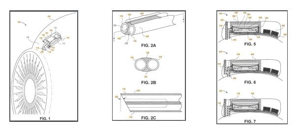 Today’s Patent – Implantable Extracompartmental pressure sensor