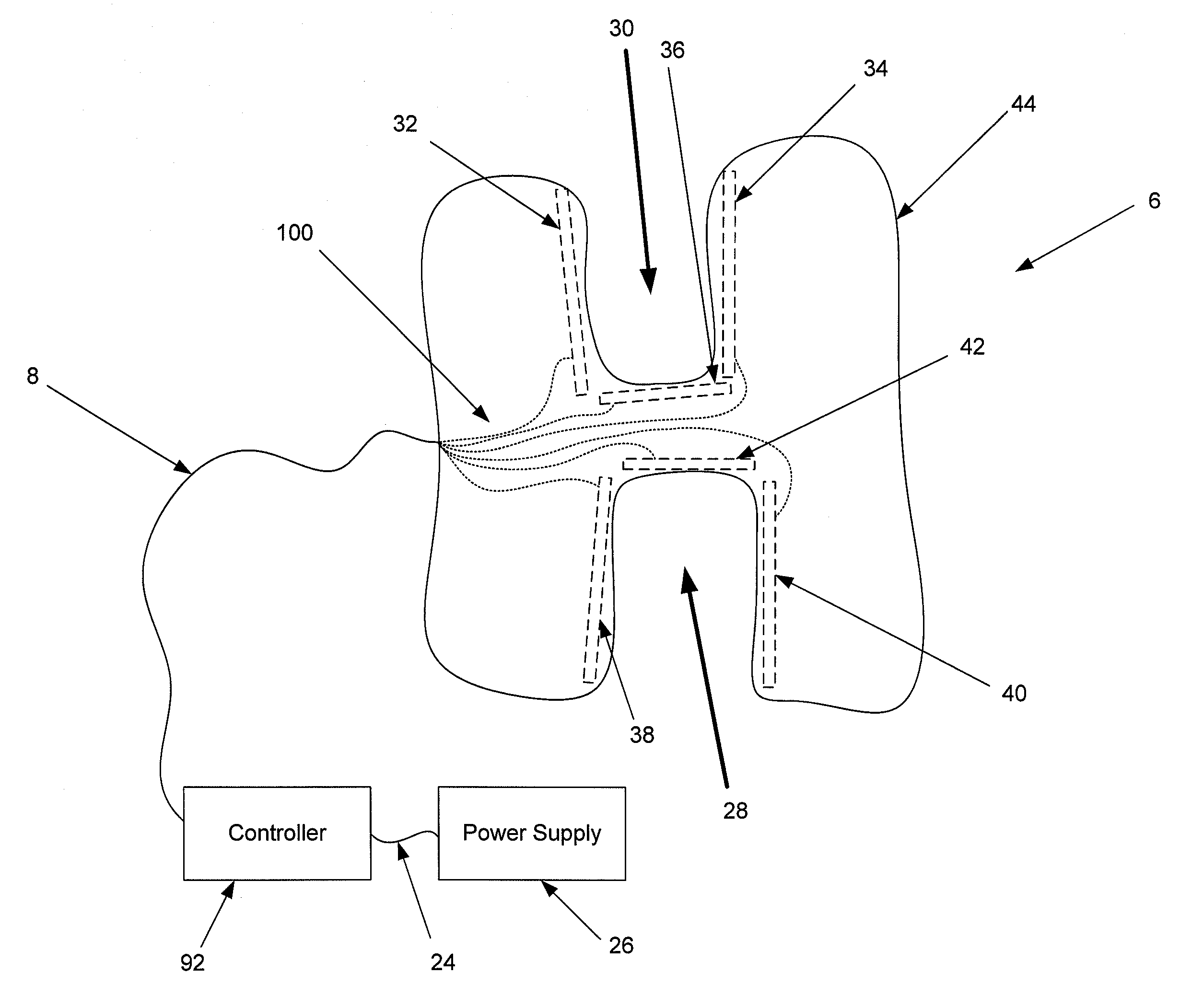 TODAY’S PATENT – SYSTEM AND METHOD FOR TEETH CLEANING&nbsp;