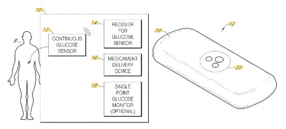 Today’s Patent – Integrated Insulin Delivery System with Continuous Glucose Sensor