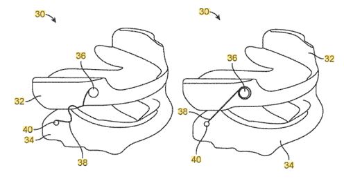 Today’s Patent – Devices for Positioning a Patient’s Mandible