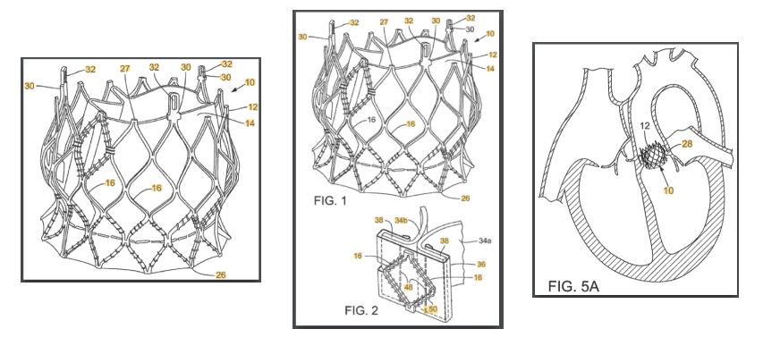 Today’s Patent – Prosthetic heart valve and delivery apparatus