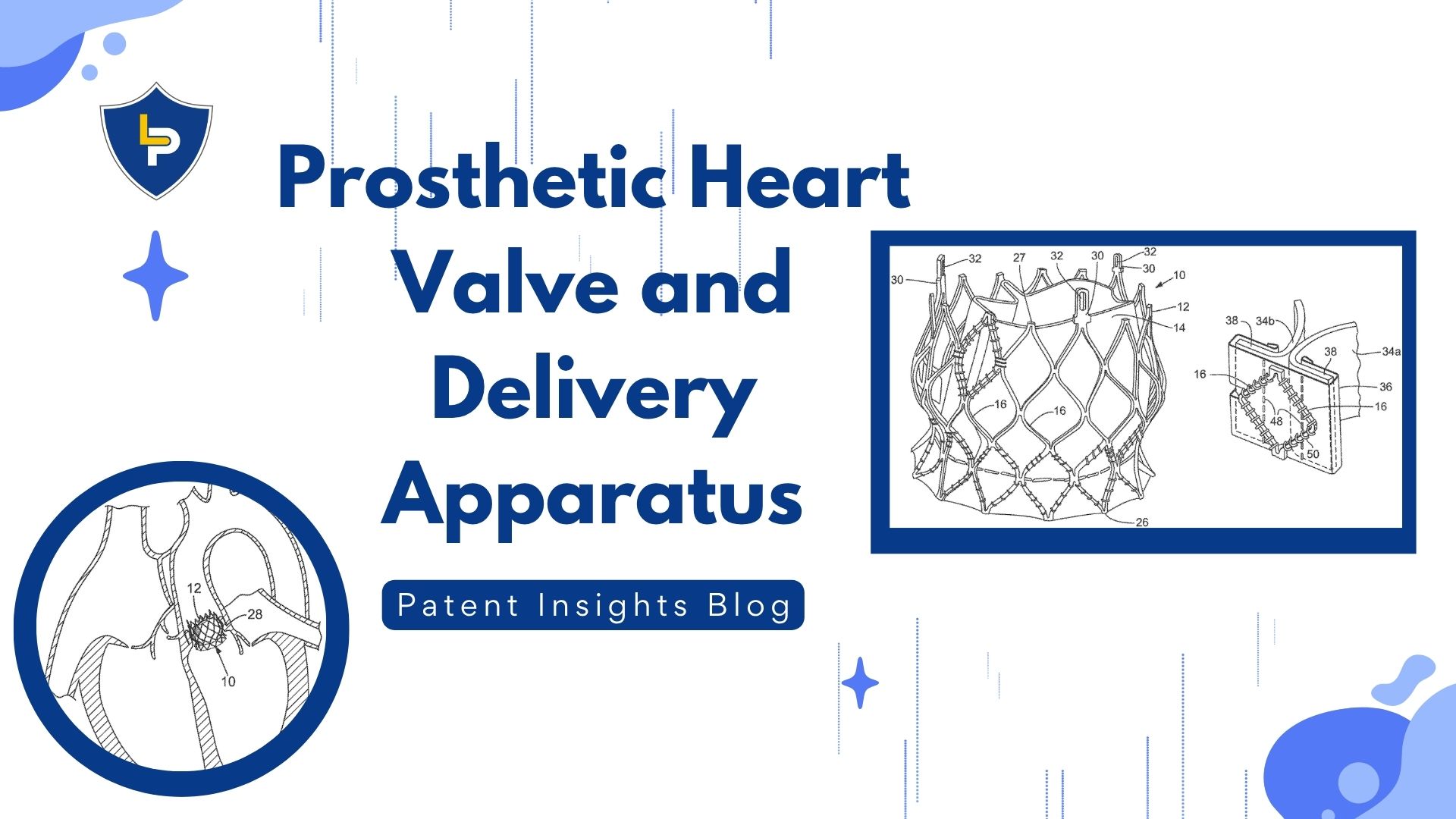 Today’s Patent – Prosthetic Heart Valve and Delivery Apparatus
