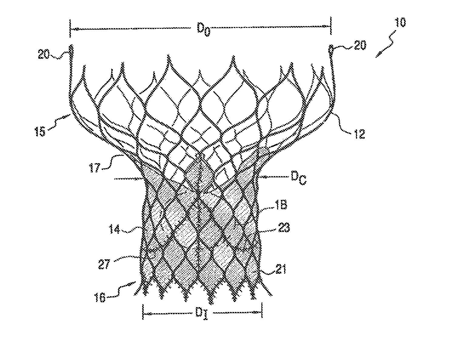 TODAY’S PATENT – HEART VALVE PROSTHESIS AND METHODS OF MANUFACTURE AND USE