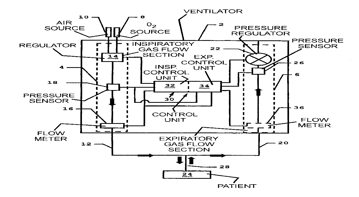 TODAY’S PATENT – MECHANICAL BREATHING AID WITH ADAPTIVE EXPIRATION CONTROL